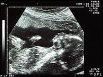 Treating The Diseased Unborn With Gene Therapy